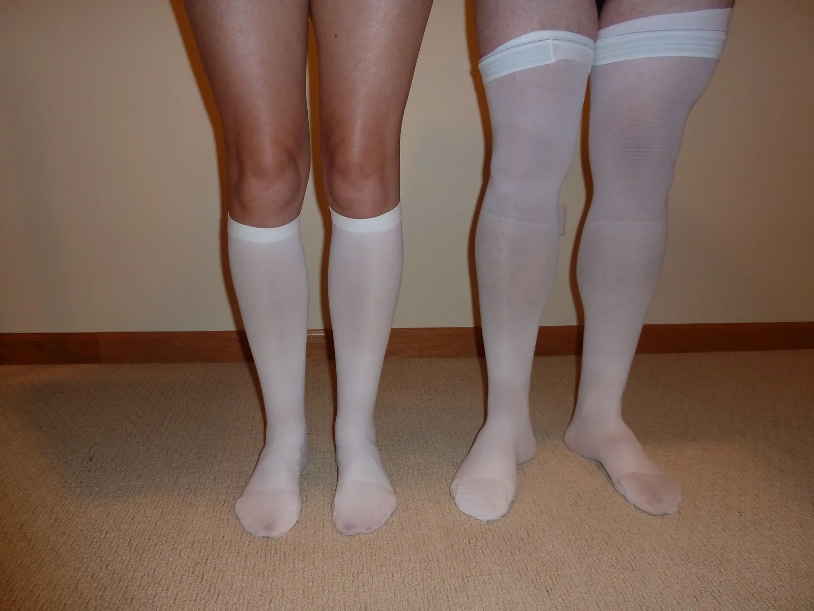 Knee-high and thigh-high graduated compression stockings used to reduce leg swelling